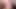Fetish Fuck X-rays on a Street Balcony. A French Blonde is Fucked in All Holes. Rimjob. Milking Tits. Butt Plug. Creampie